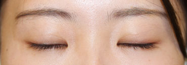 修正後8カ月（初回～1年8カ月後）