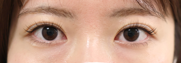 修正後1年4カ月