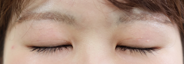 1カ月後（初回～3年7カ月後）