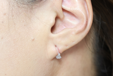 1.5カ月後シリコンチューブ