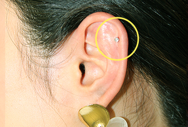 ヘリックスピアス装着