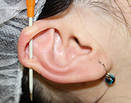 ニードルで穴開け