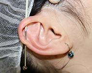 インダストリアルピアスを挿入