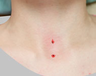 マディソンピアス穴あけ位置に目印