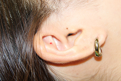 ルークピアスの目印