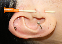 バーティカルトラガス