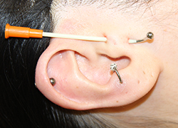 バーティカルトラガス