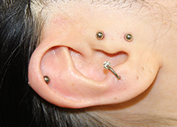 バーティカルトラガス