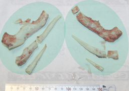 採取した肋軟骨