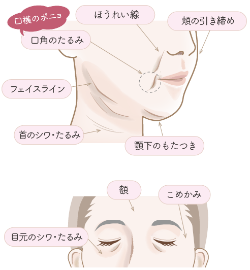 たるみ・シワのお悩み部位
